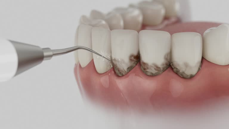 Trusted Root Canal Treatment service in Bret Harte, CA - Dentist Open Now